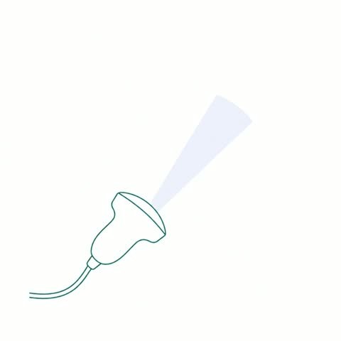 Probe Beam